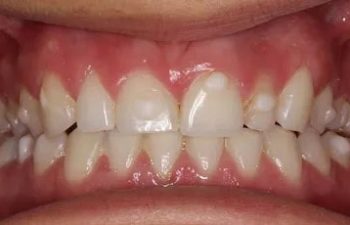 Photo before the dental treatment