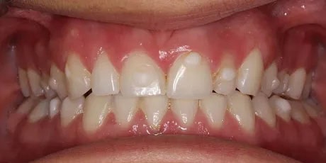 Photo before the dental treatment