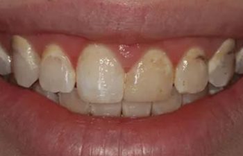 Photo before the dental treatment