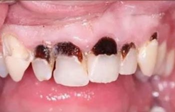 Photo before the dental treatment