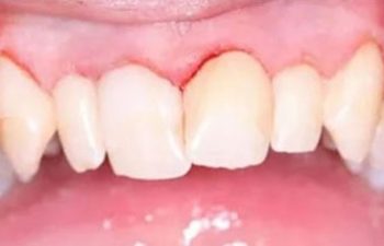 Photo before the dental treatment